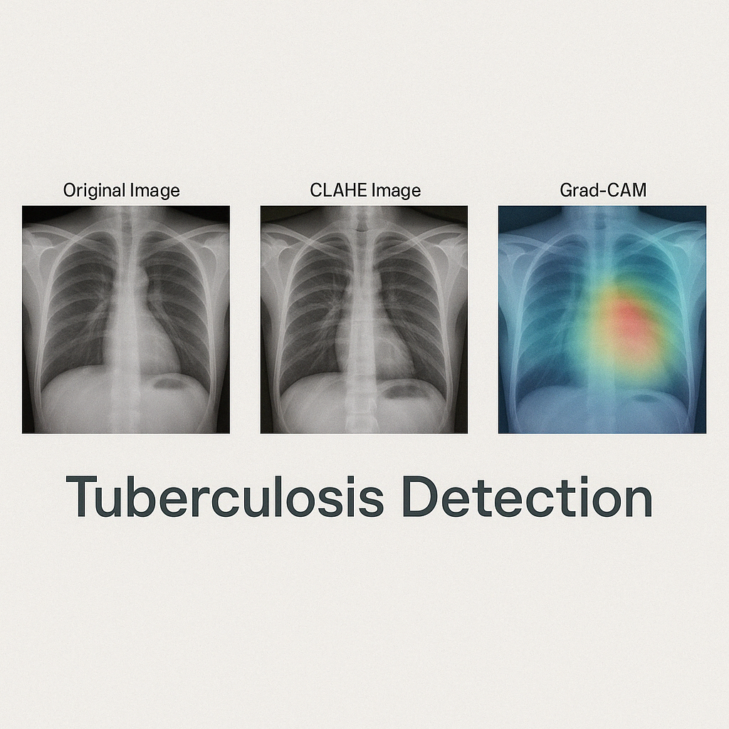 A Comparative Study of Detection of Tuberculosis using ML & DL